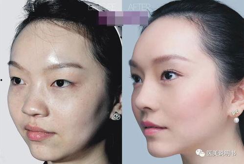 新疆整形爆料案件最新,揭开美容行业乱象背后的真相
